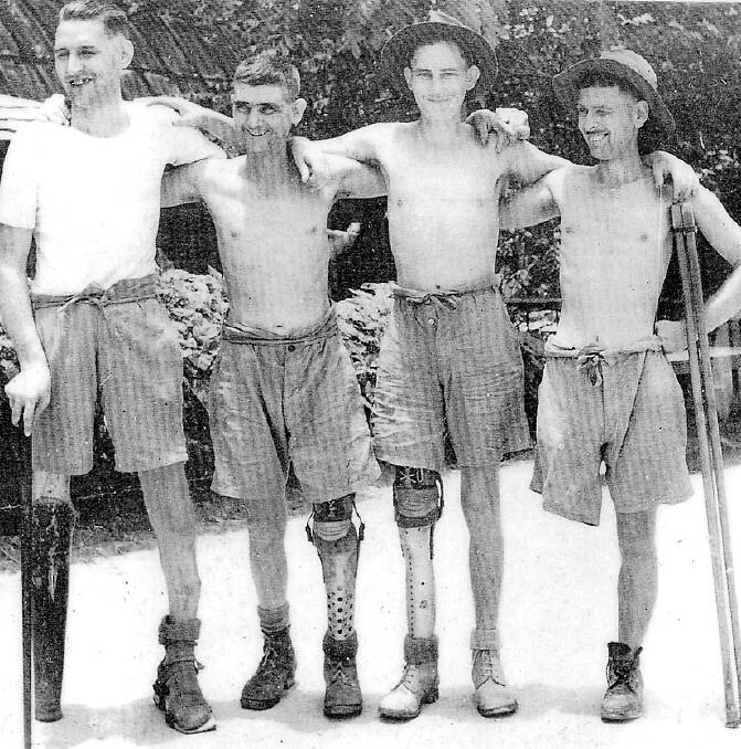 Hideous ulcers caused many amputations on the Burma - Thailand railway. These men are wearing artificial limbs made in Changi by WO Arthur Puden of East Maitland. Pictured far right is Boggabri's Pte Alex McKenzie.